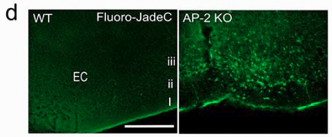 Fluoro-Jade C（FJC）染色试剂盒nature发表文章结果图